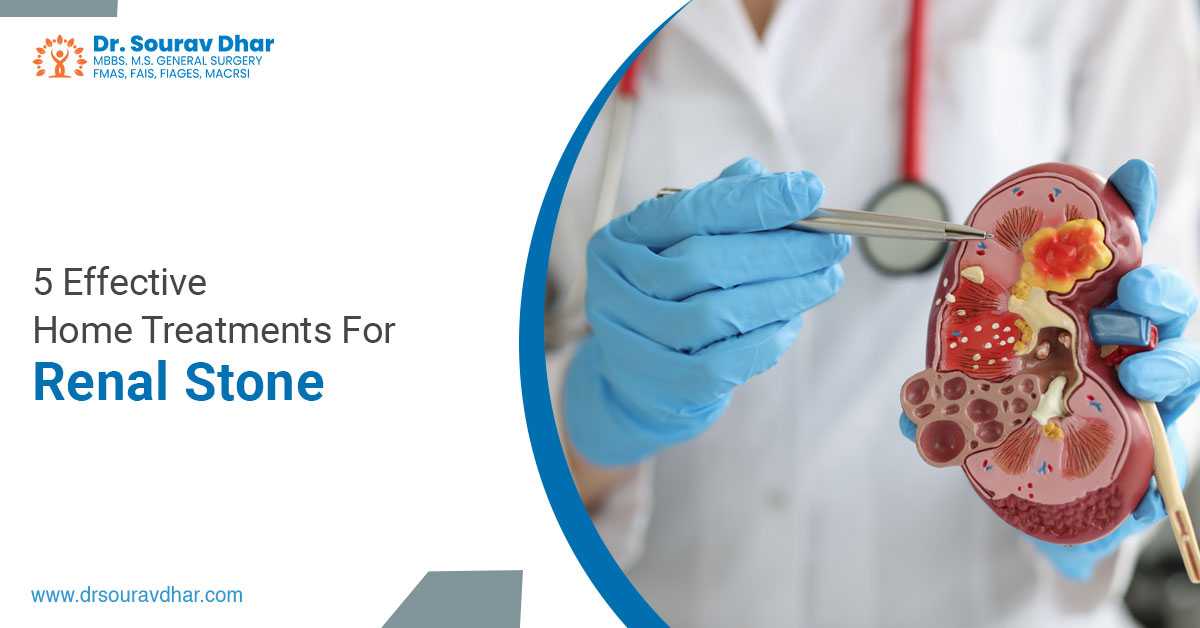 5 Effective Home Treatments For Renal Stone
