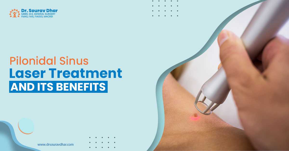 Laser Pilonidal sinus surgery in Siliguri