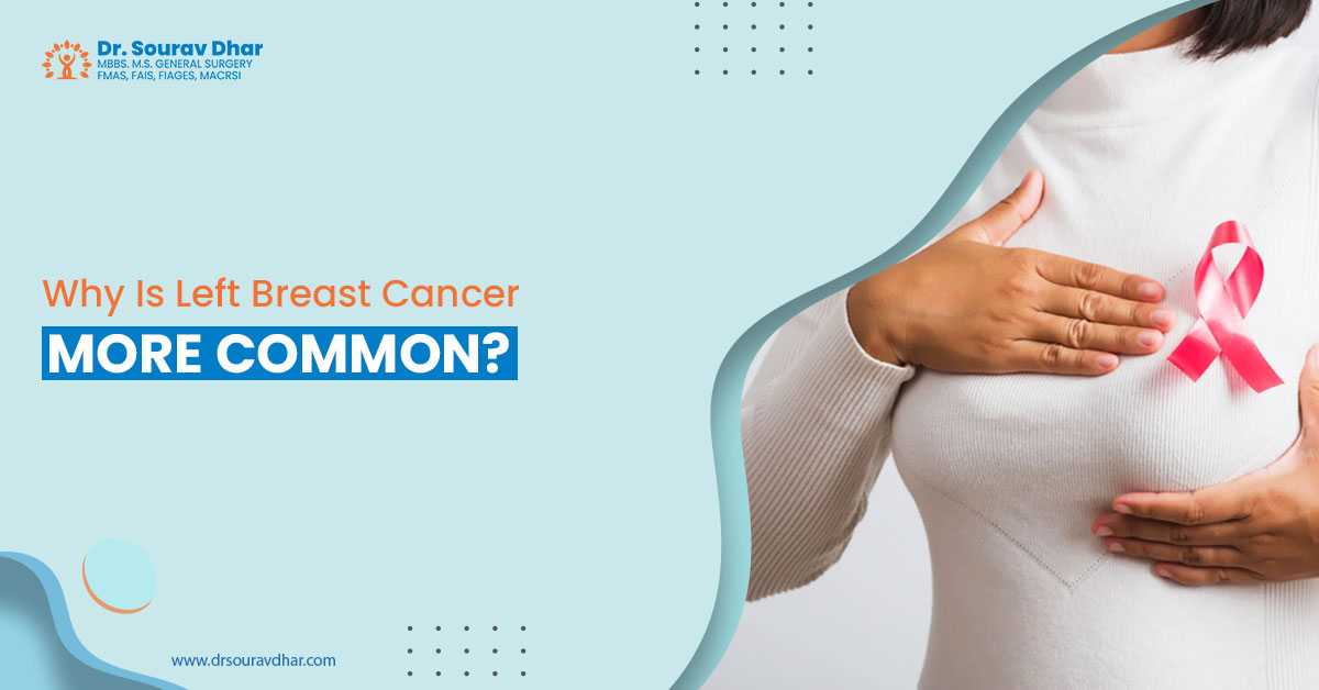 Breast cancer doctor in Siliguri