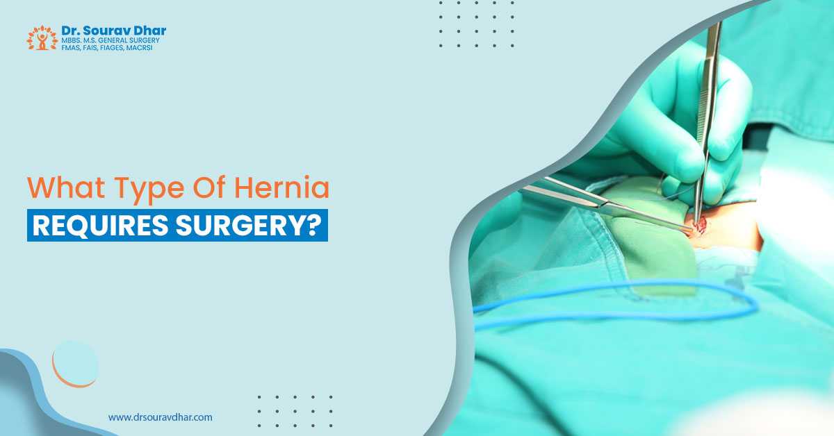 best general surgeon in Siliguri