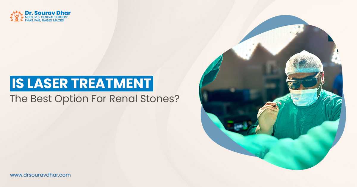 renal stone in siliguri