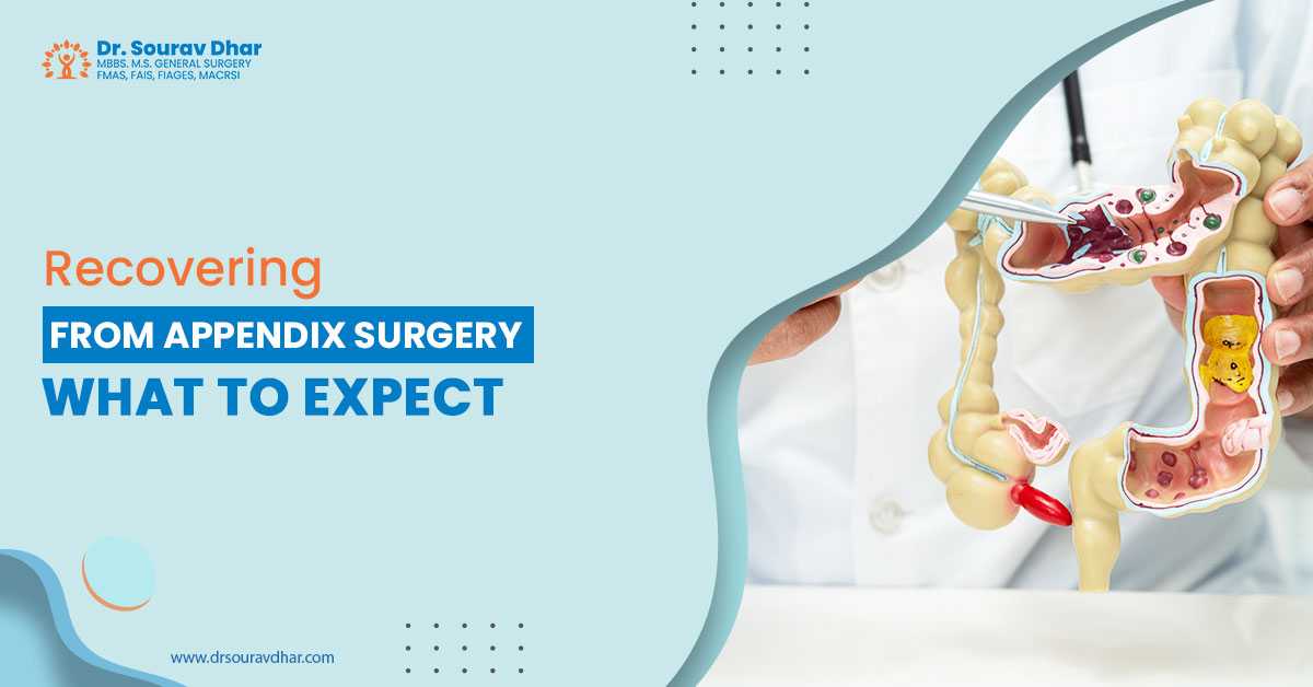 Appendix Surgery in Siliguri