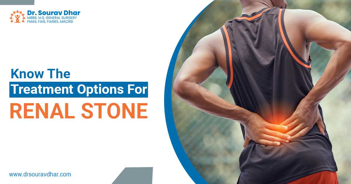 Know The Treatment Options For Renal Stone
