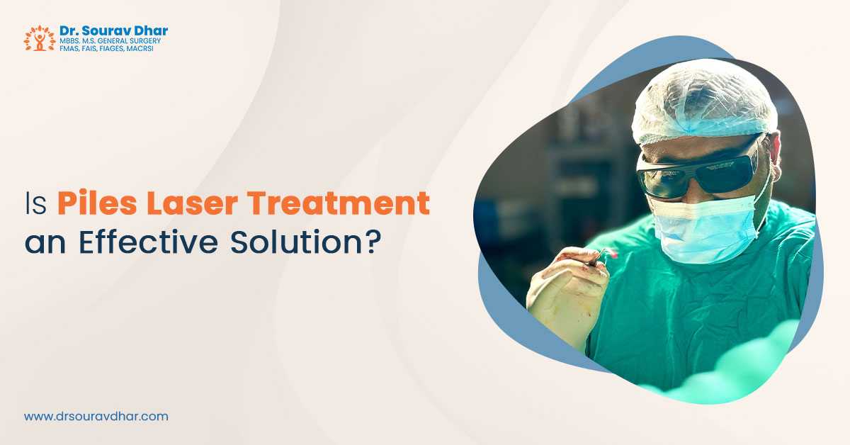 Is Piles Laser Treatment an Effective Solution?