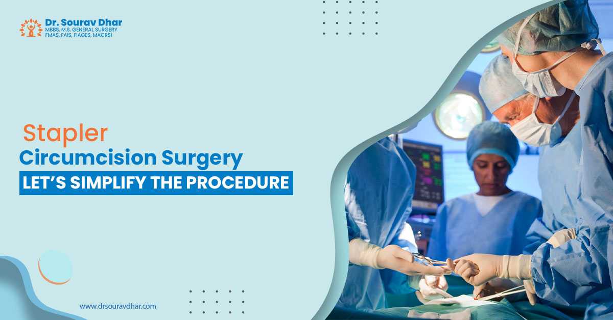 stapler circumcision surgery in siliguri