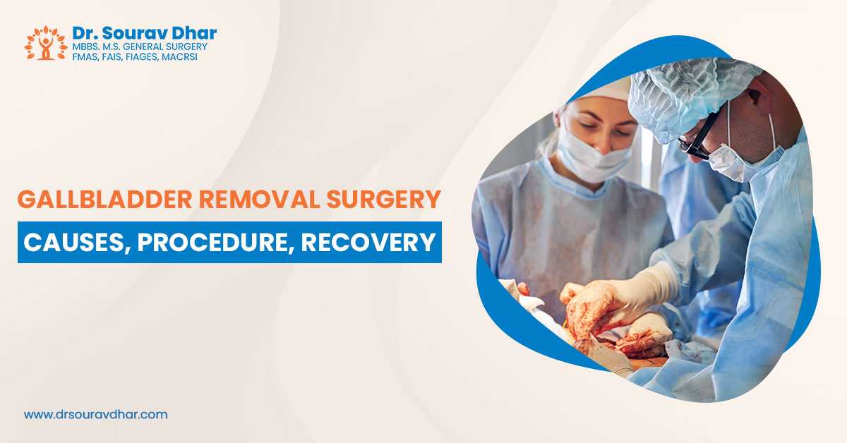 Gall Bladder Surgery in Siliguri
