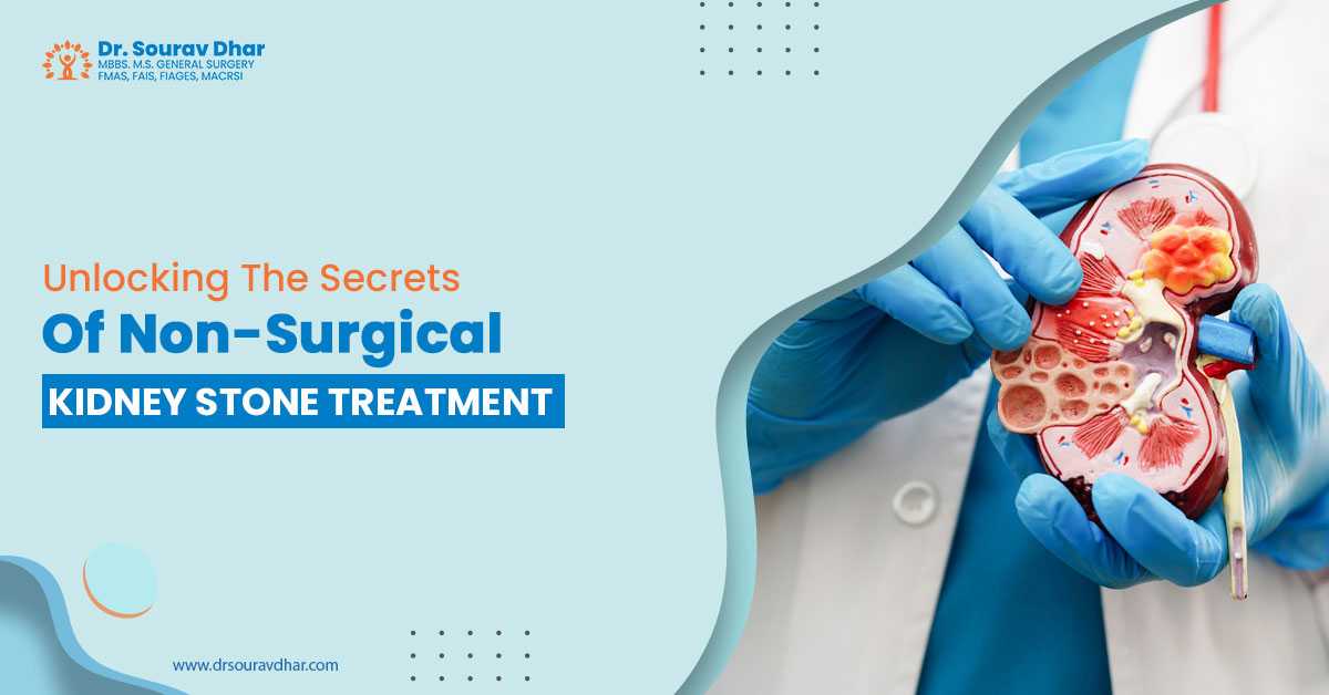 kidney stone treatment in Siliguri