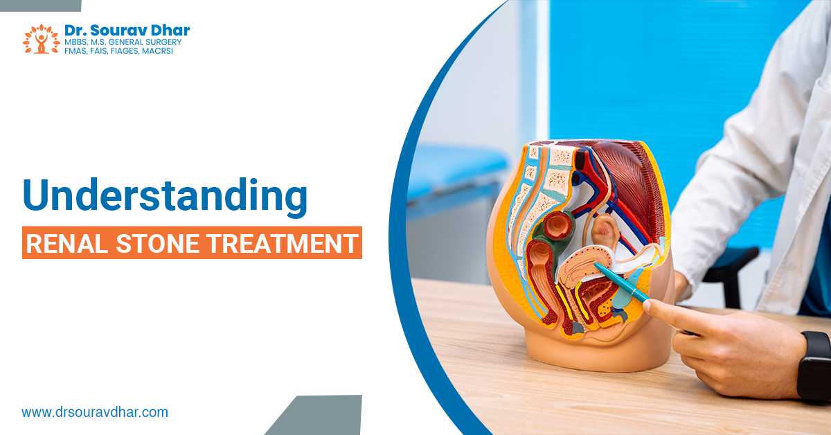 A Complete Guide To Renal Stone & Its Treatment