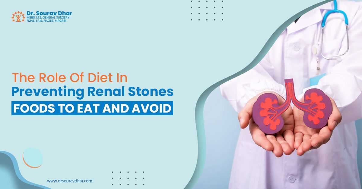 Renal Stone in siliguri