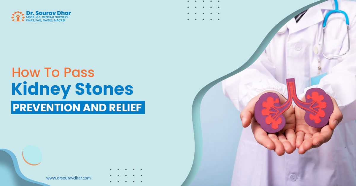 kidney stone treatment in Siliguri