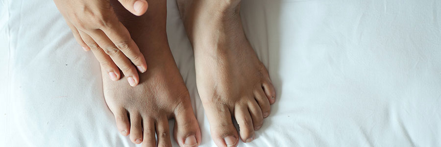 Diabetic Foot