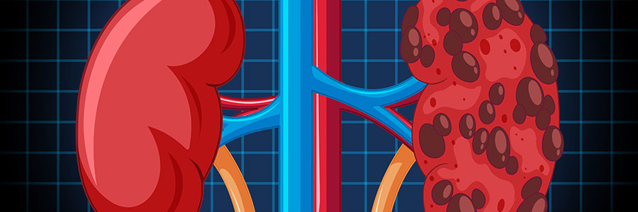 Urology Care